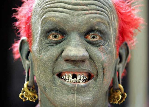 Gold-Teeth.jpg
