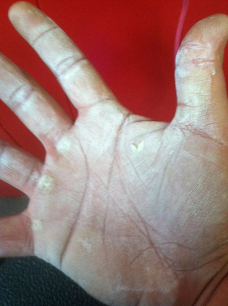 hand.JPG