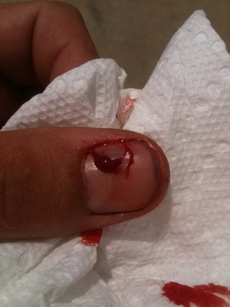 thumb.JPG
